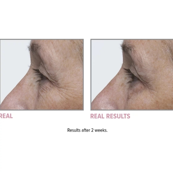 SAMPLE SZ. IT COSMETICS CONFIDENCE IN AN EYE CREAM - Picture 5 of 8